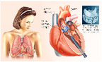 Tavi-fotolia-76356839-m1